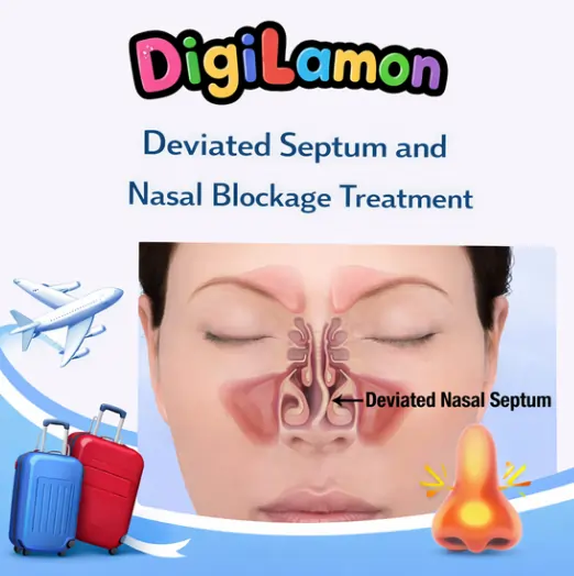 Deviated Septum and Nasal Blockage Treatment